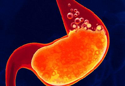 胃不舒服胃酸应该怎么办,胃不舒服胃酸怎么缓解