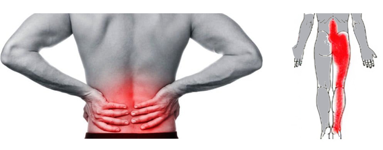 腰椎退行变性是什么原因,腰椎退变治愈的可能性