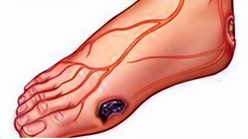 几块钱一瓶甲硝唑能治什么病,甲硝唑一瓶