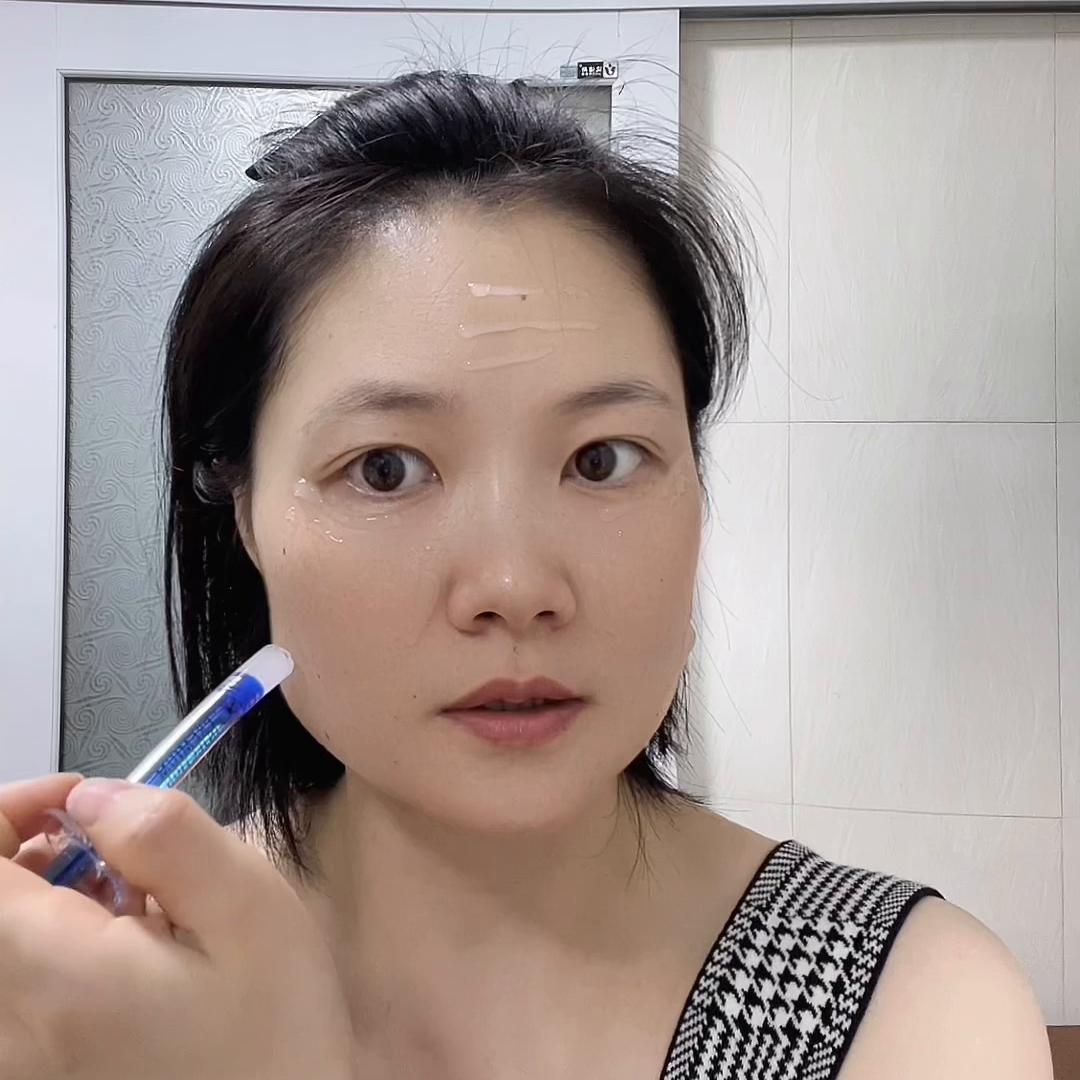 日本sc精华微针水光针效果,sc水光微针效果怎样