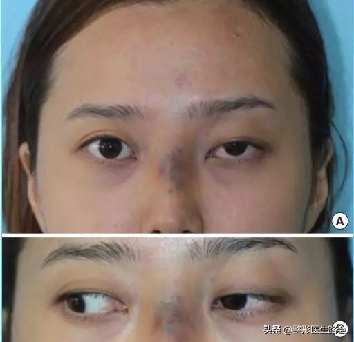 揭秘你所不知道的整形医生,做过整形的来说说你的经历