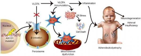 罕见病脑白质可以治好吗,基因疗法治疗罕见病效果好吗