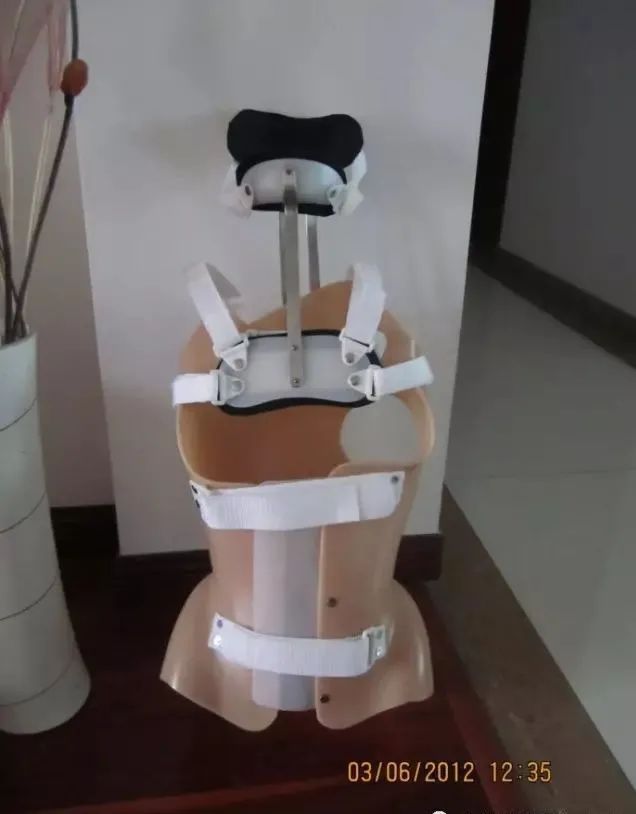 脊柱侧弯矫正支具不调整会怎样,简单辨别脊柱侧弯避免孩子走弯路