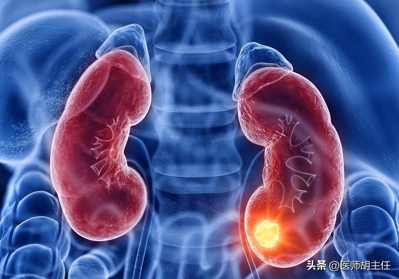除了泡沫尿，这3个症状也是肾脏受损的征兆！不要走到透析这一步