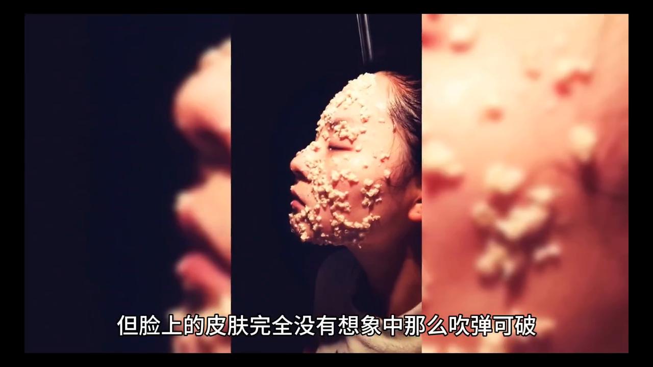 为什么脸部皮肤会发炎,为什么脸部皮肤不如身上皮肤好