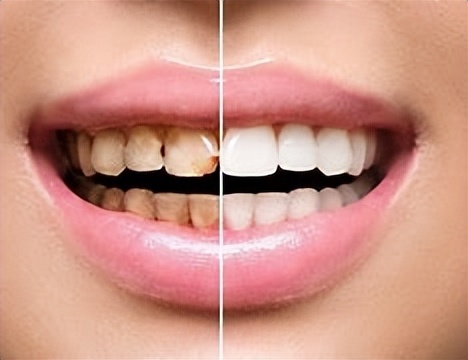 生活小技巧十个小妙招有哪些,生活小窍门100个必备小妙招