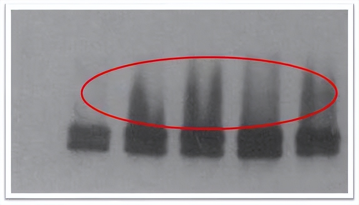 wb试验有条带为什么曝光,wb实验第二条带消失了