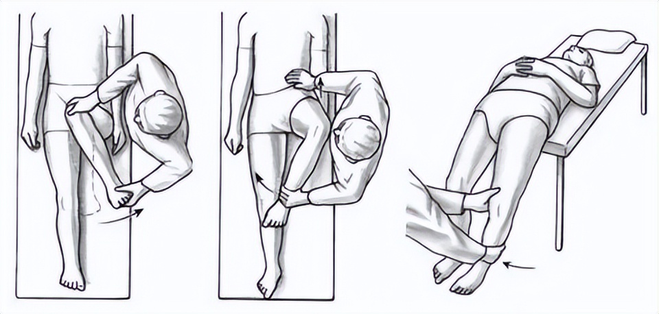 怎么才能更好的保护股骨头,换什么样的股骨头最好用