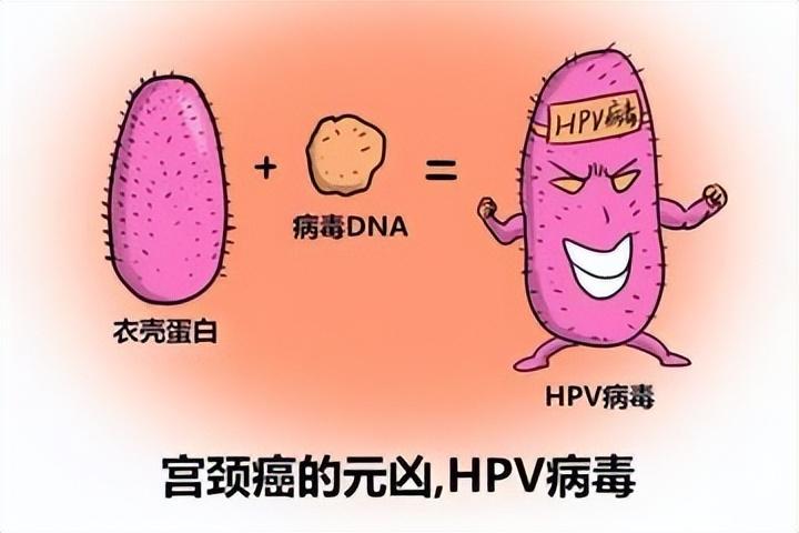 女子长期腿痛查出宫颈癌,女子患宫颈癌
