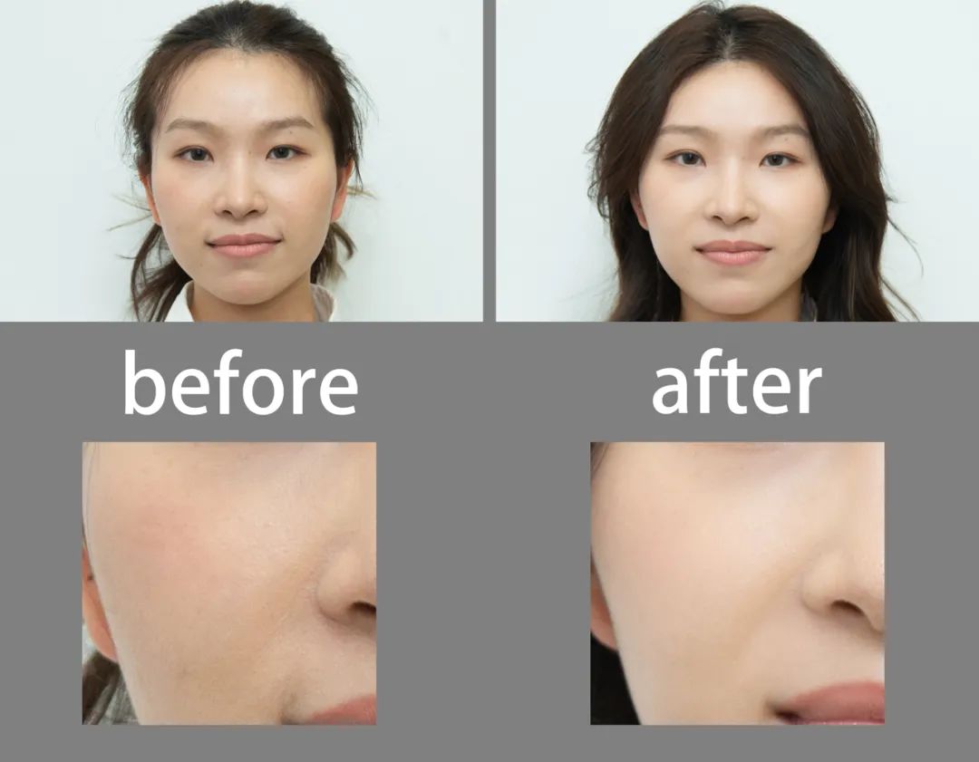 美肌试颜室‖直播见证，4周院线护肤的逆袭之路