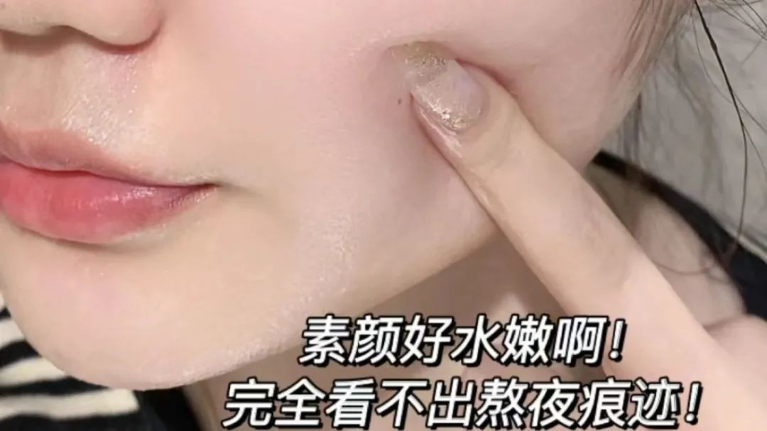 祛痘面膜淡化痘印测评,祛痘淡斑面膜测评