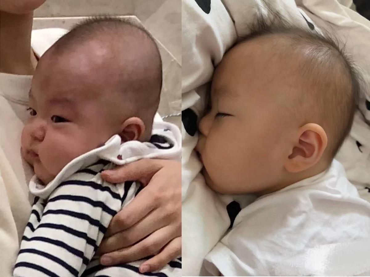 扁头有多毁颜值,扁头对颜值影响有多大