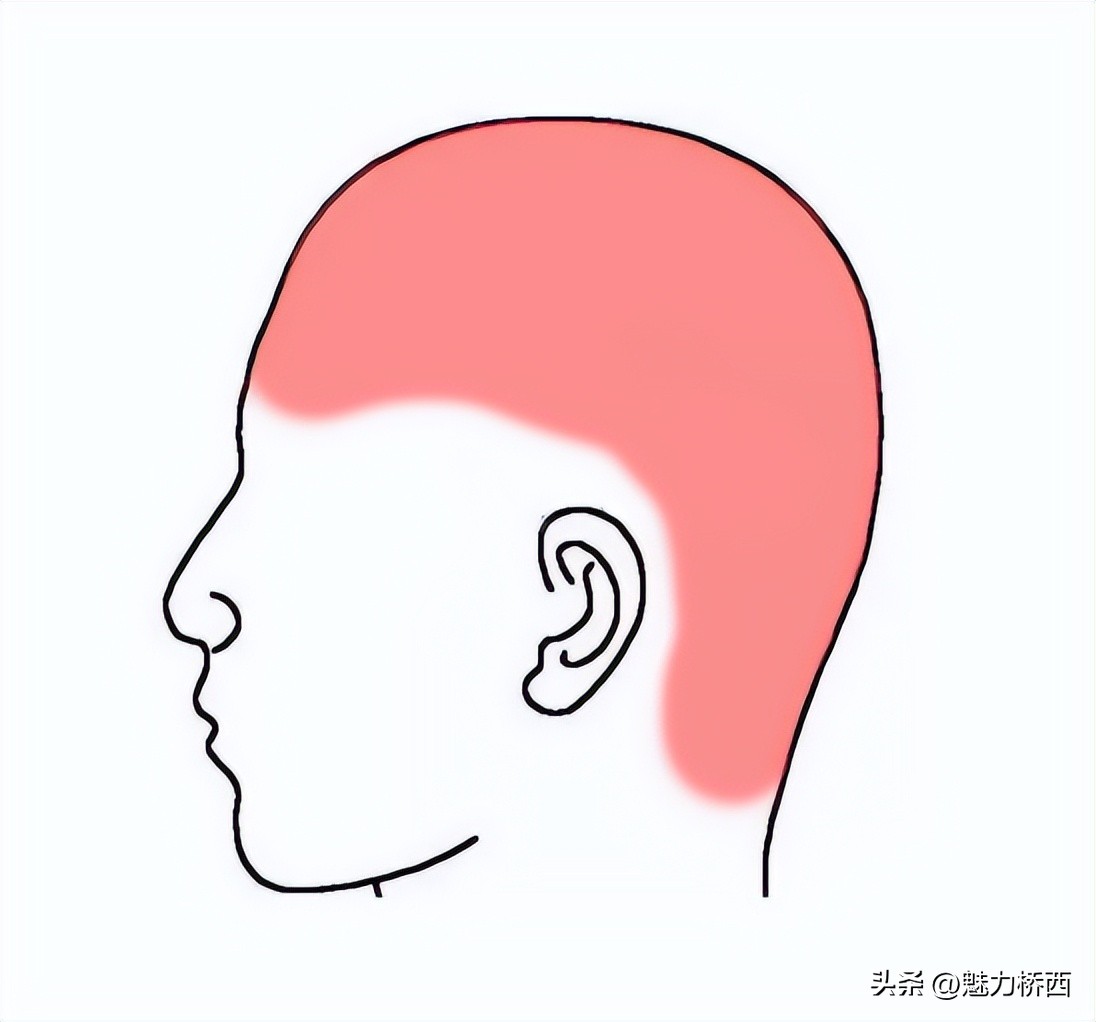 阳康之后头痛怎么办,阳康之后一直头疼是怎么回事