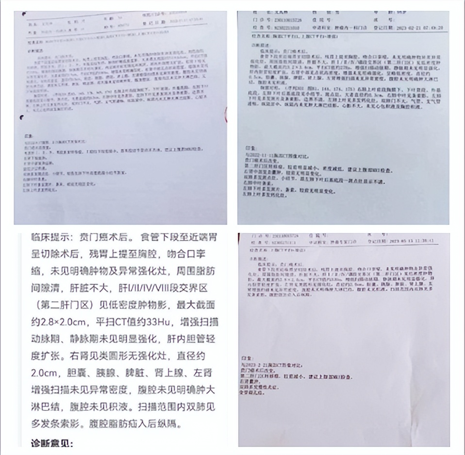 陈海林治疗癌症,陈海林肿瘤名医