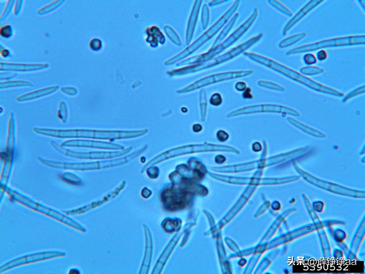 薄荷精油详细介绍,薄荷精油具有温和的能力