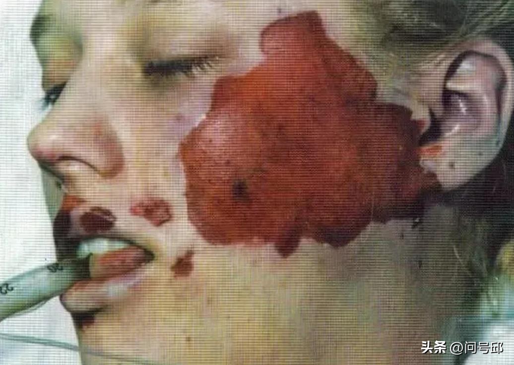 加拿大芭比娃娃夫妇凶杀案,加拿大芭比娃娃凶杀案