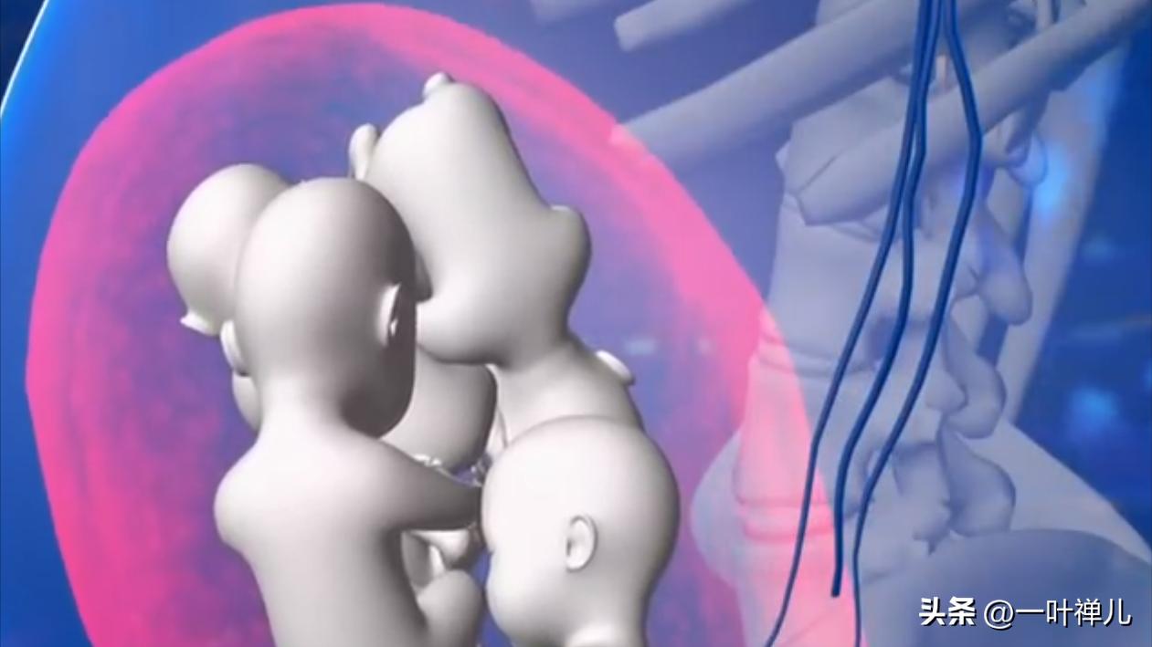 中国首例五胞胎，现年满22岁，妈妈坦言：如果重选，我一个也不要