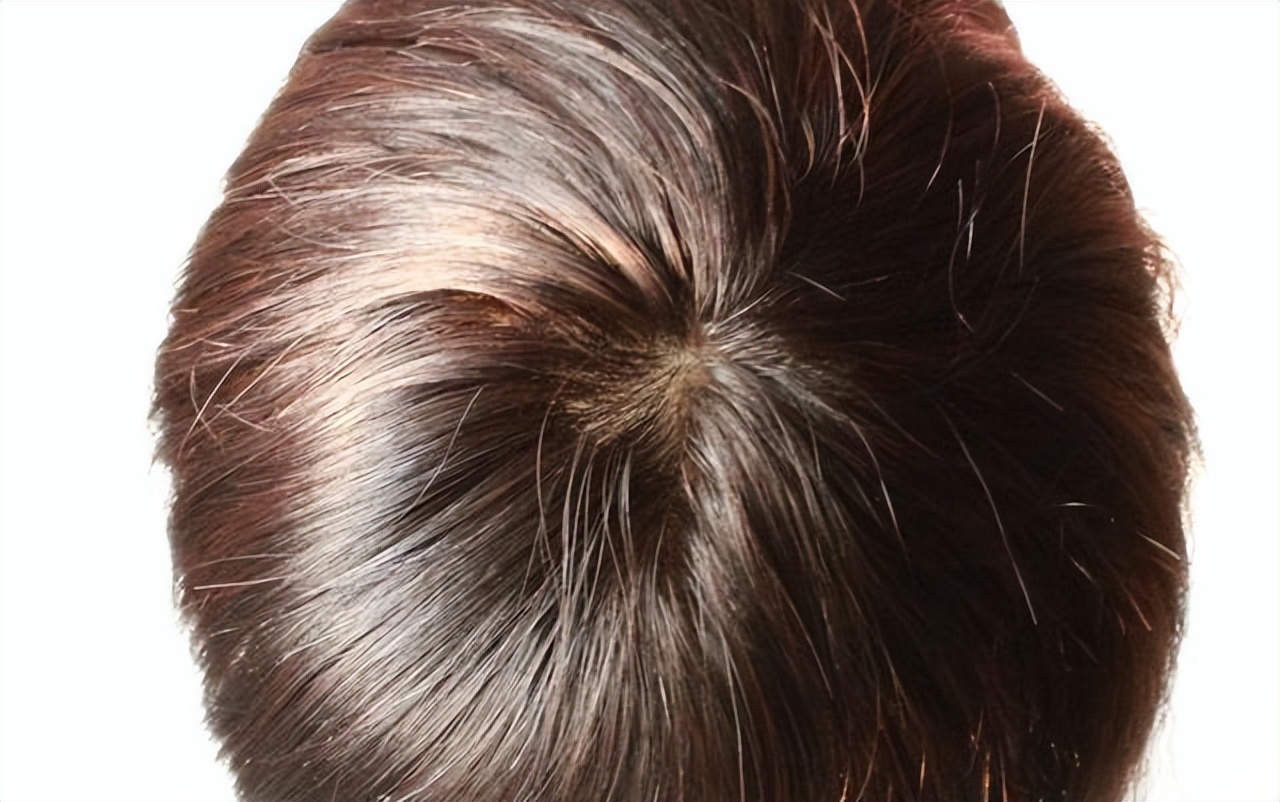 孩子头上的旋代表什么,小孩头顶的旋很重有什么寓意