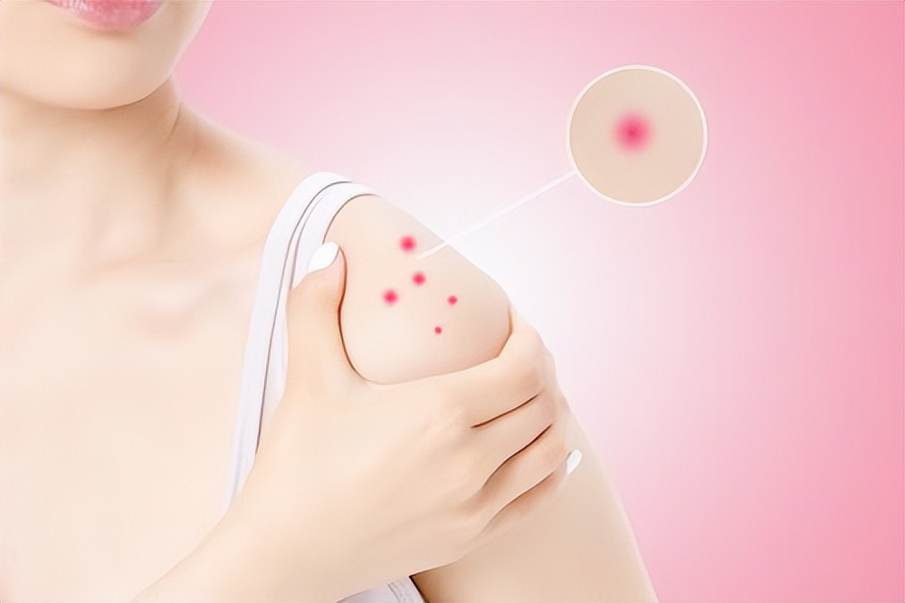 2块钱一袋的甲硝唑有副作用吗,几块钱一瓶的甲硝唑有什么作用