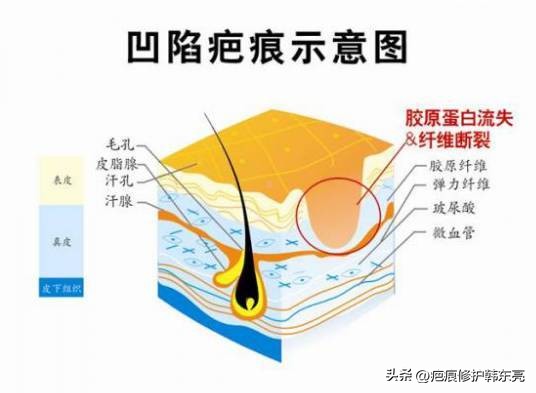 疤痕修复一次需要多少钱,上海九医院疤痕修复价目表2021