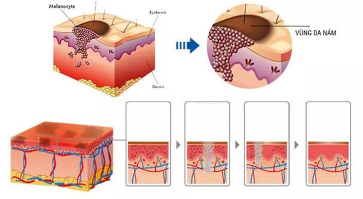 瓷娃娃美白嫩肤护理,白瓷娃娃美白嫩肤