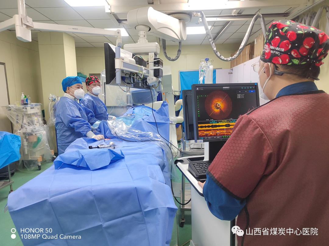 OCT辅助介入诊疗无植入！山西省煤炭中心医院成功抢救一名35岁急性心肌梗死患者