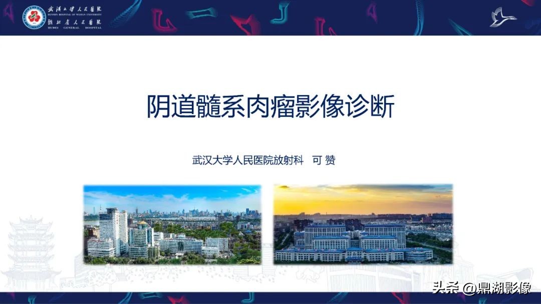 阴道肉瘤症状,阴道肉瘤的早期症状