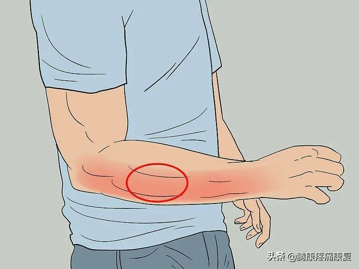 前臂疼痛，这五个动作就能缓解