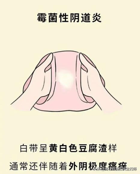 住院医生让我去买药,住院期间医生叫我去门诊开药