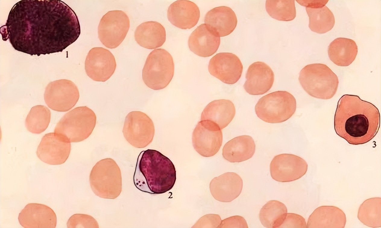 血常规检查各种比例指标下降,血常规四个指标升高需要注意什么