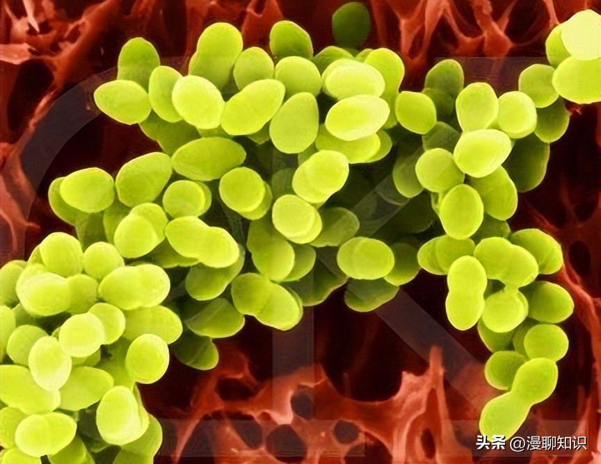 牦牛是高山地区牛的独特品种，肉质鲜嫩，但却饱受葡萄球菌的侵害