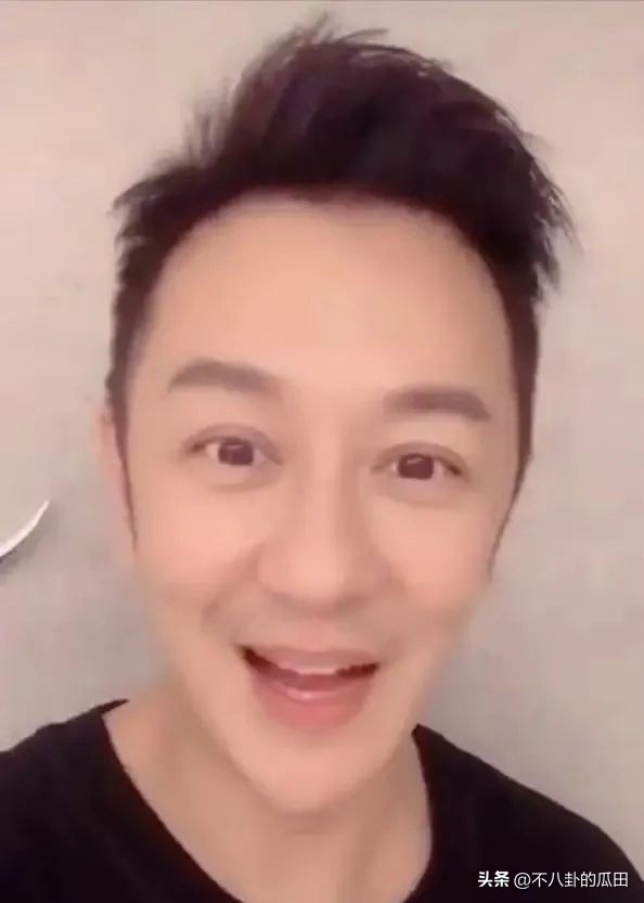 蔡徐坤下巴太尖惹争议图片,蔡徐坤下巴是假体吗