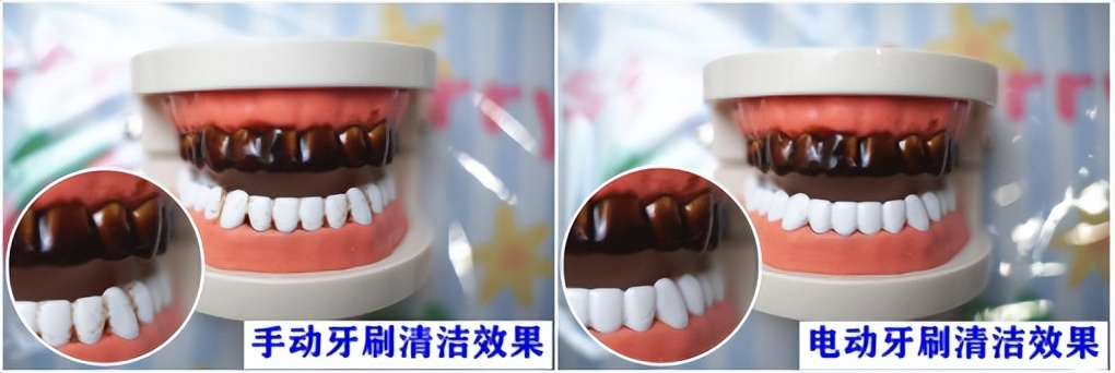儿童用电动牙刷的好处与坏处,电动牙刷刷牙的好处和坏处