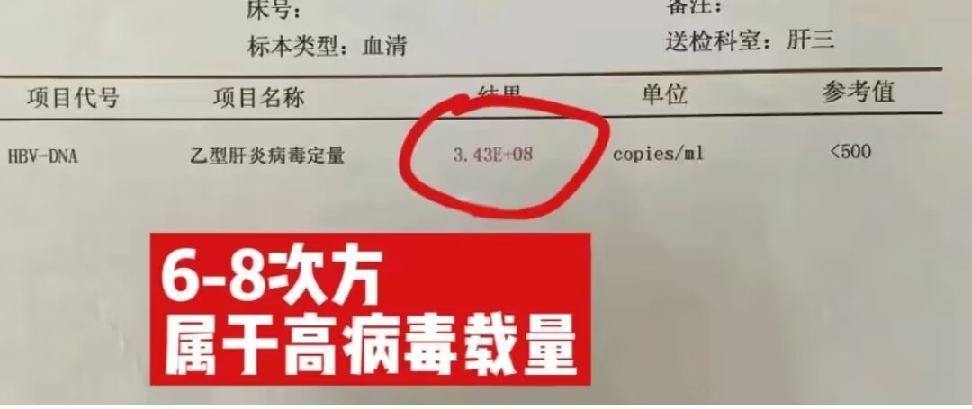 乙肝病毒c抗体数值比较高一点,乙肝病毒滴度高低说明了什么
