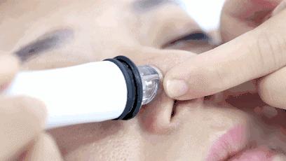 整形医生的未来趋势,为什么医美都不建议削骨