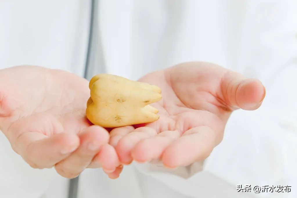 牙齿上黑色的斑点可以洗干净吗,牙齿牙渍斑很黄刷牙能去掉吗