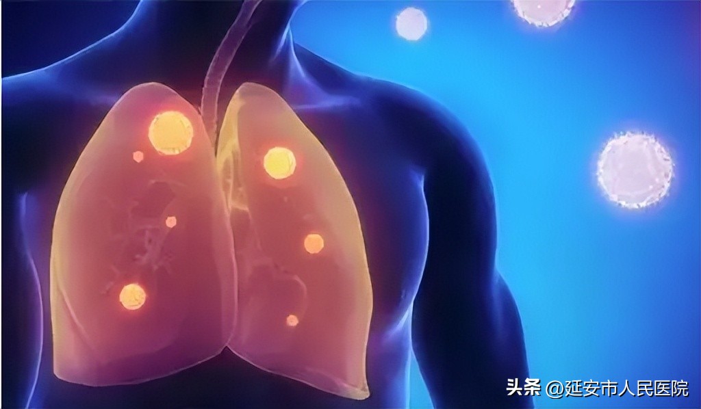 硬化性肺细胞瘤的治疗和预后,硬化性肺细胞瘤36例临床分析