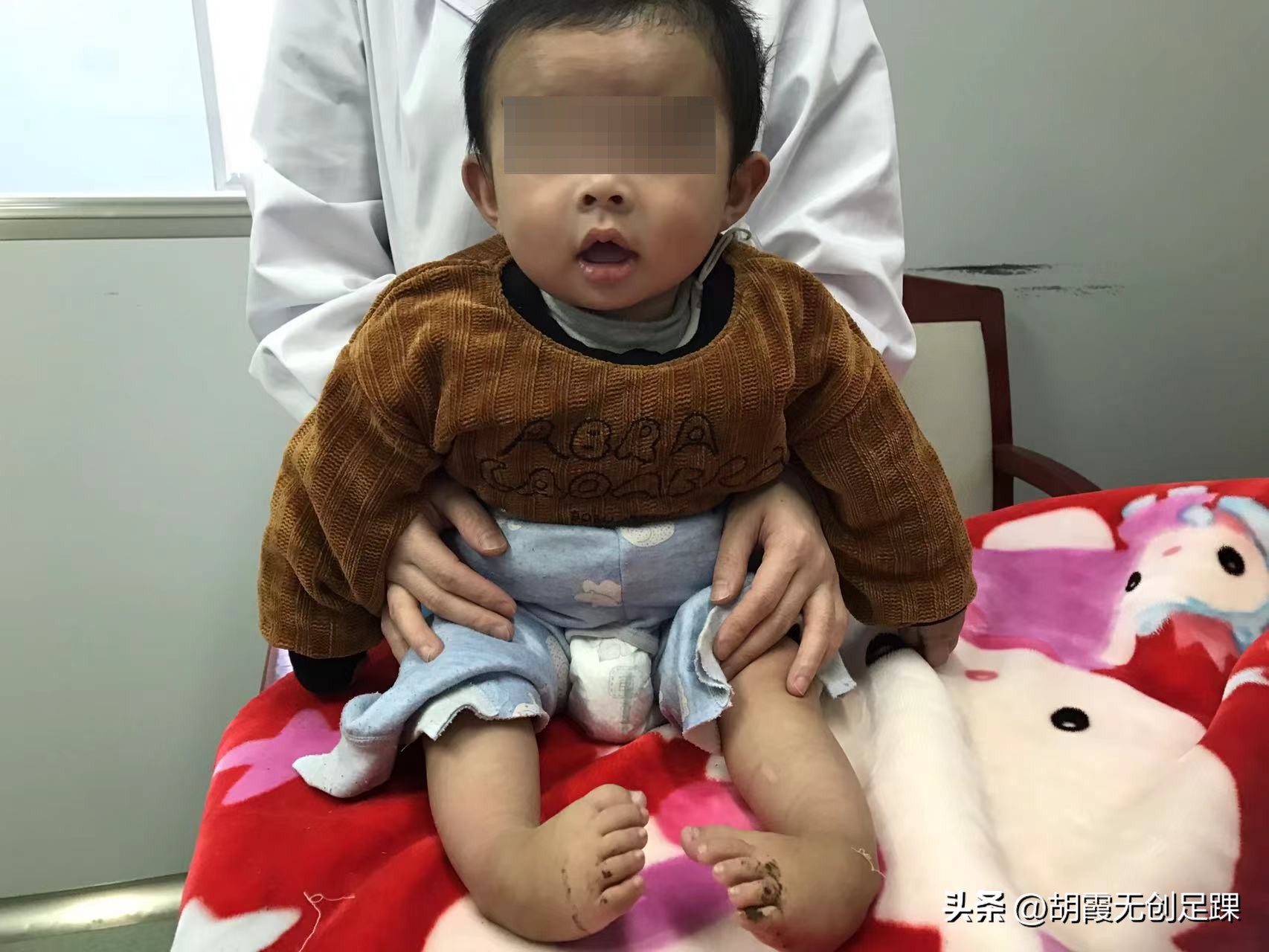 儿童足内翻最快的恢复方法,小儿足内翻怎么判断