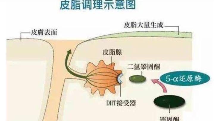 男子秃顶半月不用洗发水后长出头发网友：洗发水公司要破产了