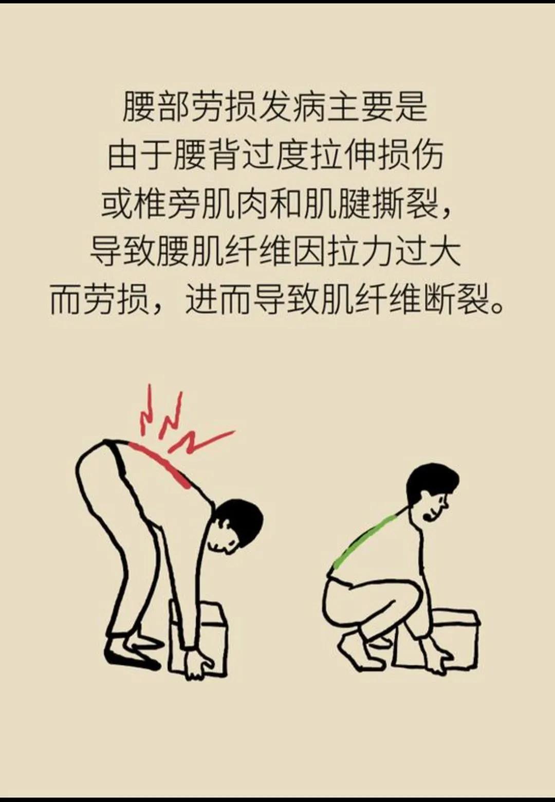 什么是腰肌劳损中医,什么是腰肌劳损