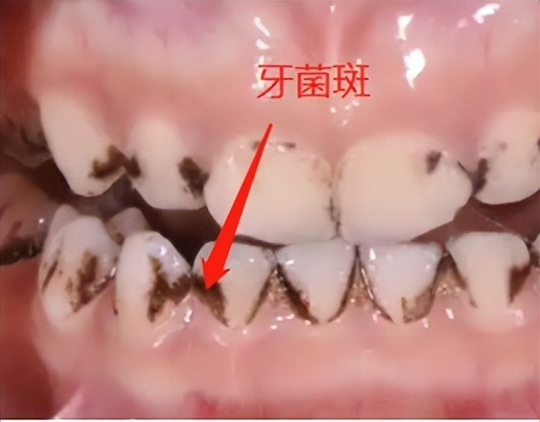 口腔护理牙齿步骤,牙科小常识牙齿敏感