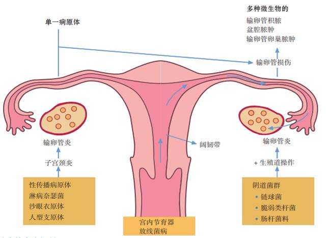 关爱女性健康妇科知识,关爱女性健康从预防妇科炎症开始