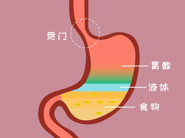 吃完饭「泛酸」的人，食管默默承受患癌风险……