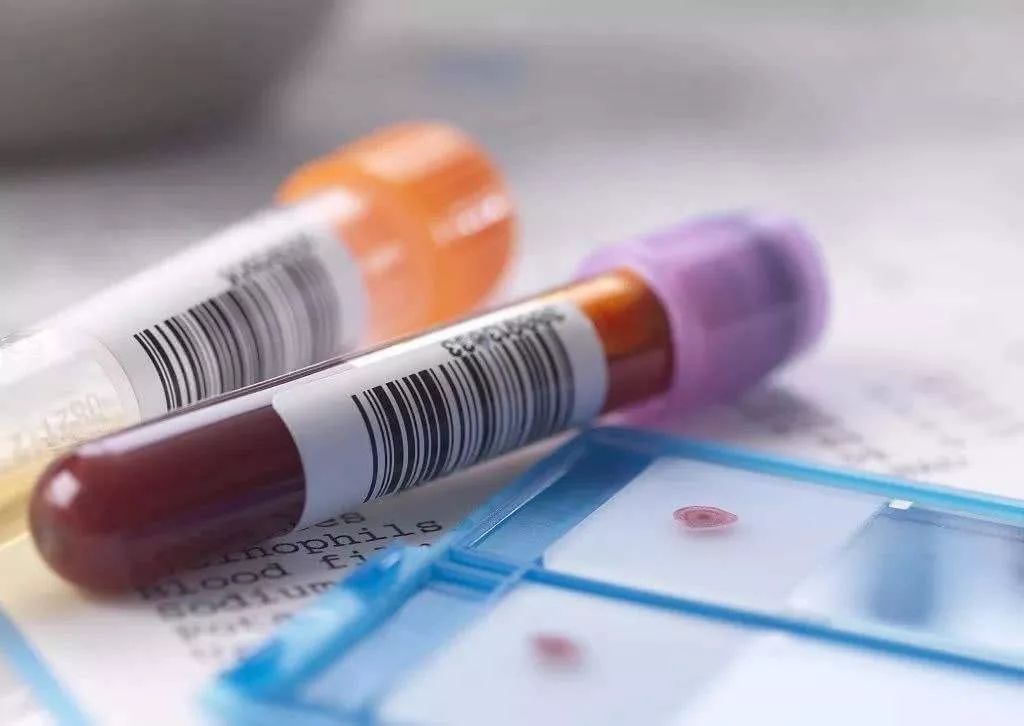 体检乙肝e抗体阳性,体检报告乙肝病毒是阳性