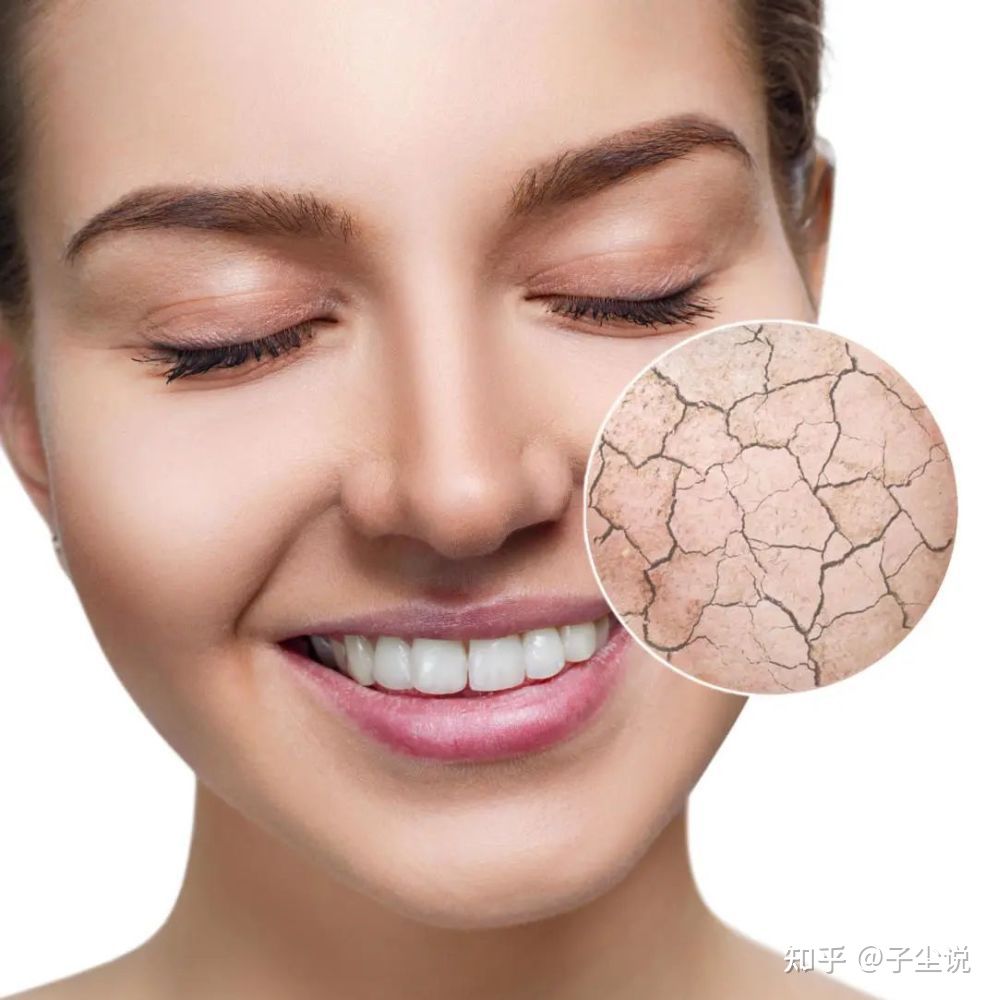 尚赫玻妃玻尿酸,尚赫玻尿酸