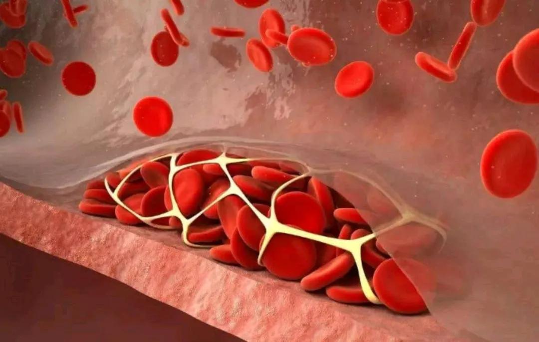 胆固醇正常范围男女一样吗,胆固醇值范围是多少正常