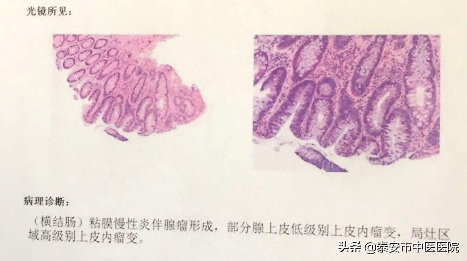 消化内镜微创诊治,消化内镜及消化疾病诊治