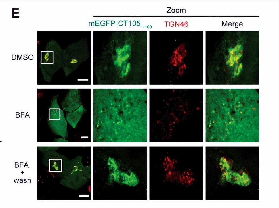 沙眼衣原体抗原阳性有什么影响,沙眼衣原体脱氧核糖核酸ctdna