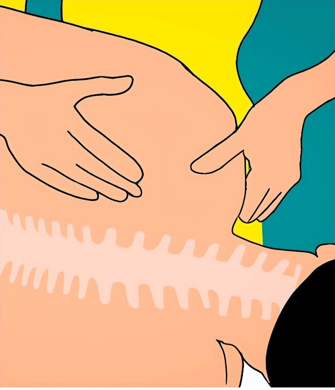 颈椎痛做了针灸可以接着按摩吗,颈椎针灸完疼痛感加重反而好得快