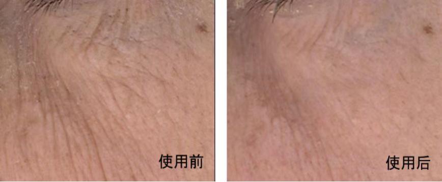 四川肽美,四川肽美生物科技有限公司怎么样